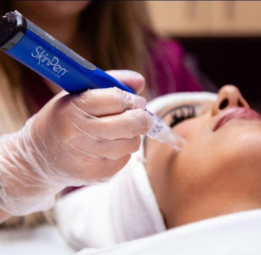 SkinPen Microneedling For Acne Scars And Aging