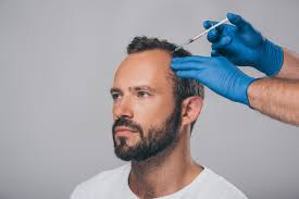 PRP For Hairloss